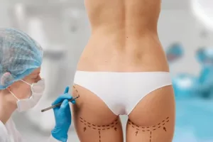 mujer-marcada-cirugia-estetica